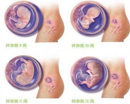做代孕哪里安全_专业的代孕包性别哪里好_试管婴儿取卵过程了解