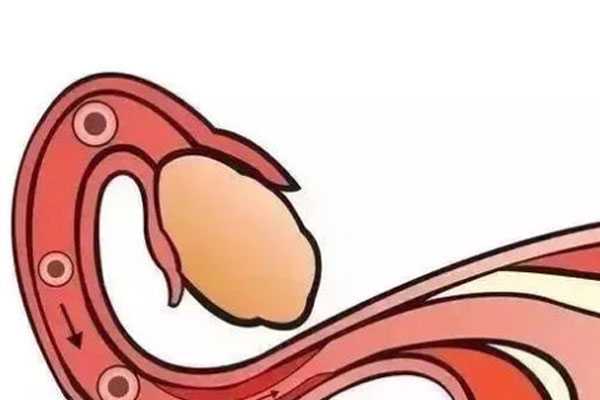 输卵管堵塞可以做试管婴儿吗？输卵管堵塞了就很难怀孕吗