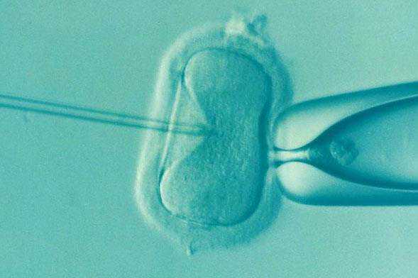 苏州正规供卵助孕包成功 苏州市立医院生殖中心介绍： ‘b超单哪里能看出是男