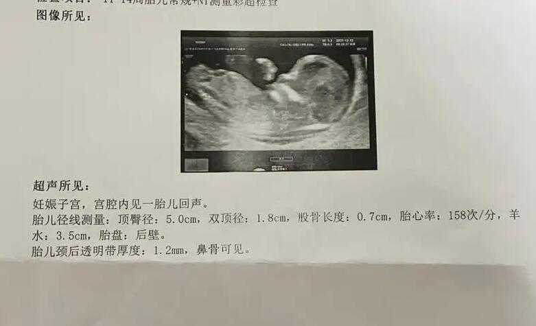 有代孕的人么_代孕辅助生殖_北京协和医院做试管婴儿成功率是多少?高龄女性试