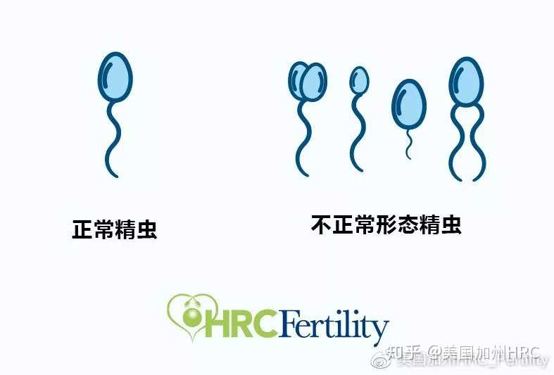 徐州高龄试管婴儿成功率高吗？,徐州私人试管婴儿医院安全吗？