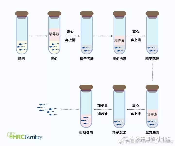 徐州高龄试管婴儿成功率高吗？,徐州私人试管婴儿医院安全吗？